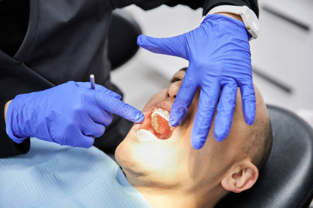 Best Emergency Treatment for Oral Infections in Elmwood Park, NJ